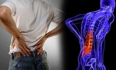 Lumbar Osteochondrosis- ի զարգացման պատճառները